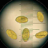 Sporenmessung vom Echten Hausschwamm im Mikroskop
